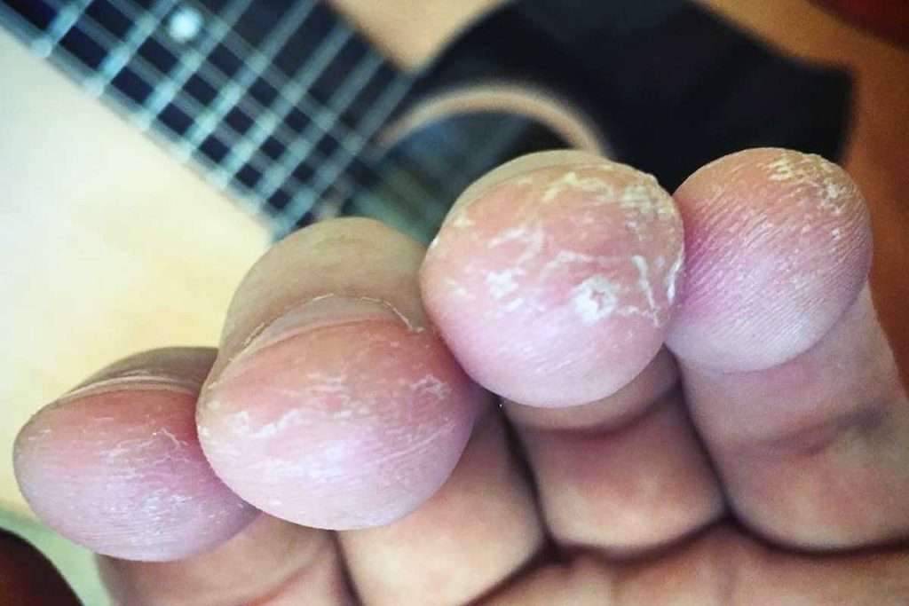 guitarist calluses, guitar player finger callus