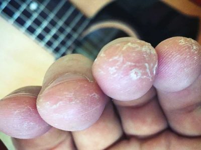 guitarist calluses, guitar player finger callus